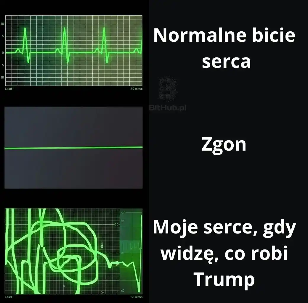 bicie-secra-mem-trump